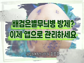 [썸네일 이미지] 배검은별무늬병 방제? 이제 앱으로 관리하세요